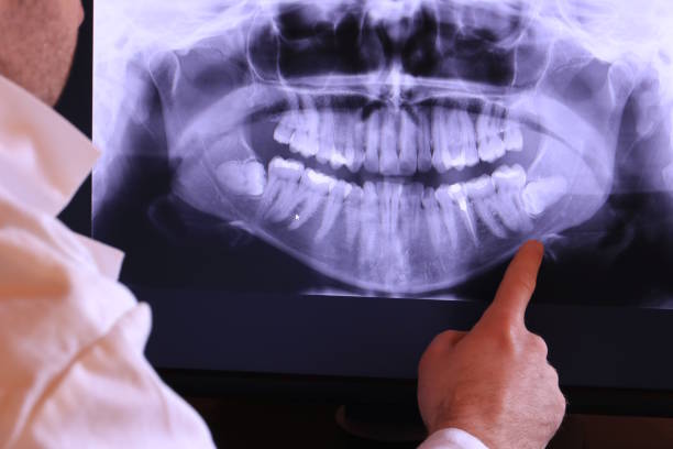 Best Emergency Treatment for Dental Infections or Abscesses in Oak Trail Shores, TX