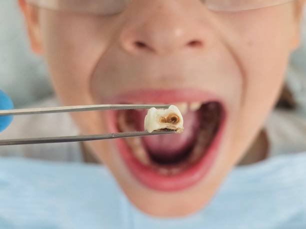 Best Urgent Care for Lost Fillings or Crowns in Oak Trail Shores, TX